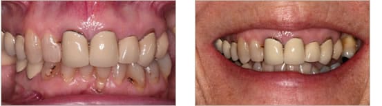 Before treatment